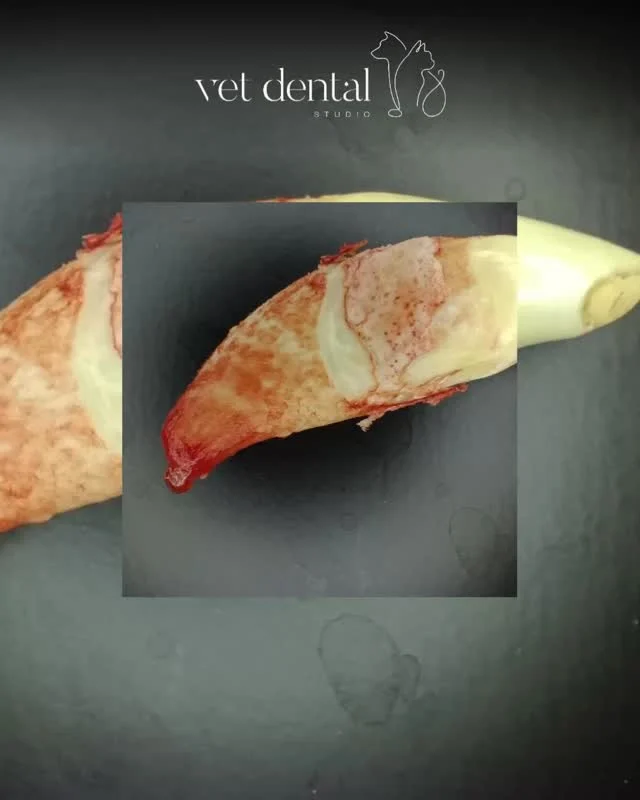 Warum ein Zahn gezogen werden muss, sieht man oft nicht auf den ersten Blick.

Du denkst vielleicht, ein Zahn besteht nur aus dem Teil, den man im Maul sieht? 🤔
Tatsächlich liegt ein grosser Teil unsichtbar im Kiefer, genauer gesagt im Knochen und unter dem Zahnfleisch, in Form der Zahnwurzel.

👉 Auf dem Bild kann man gut erkennen, wie viel vom Zahn sich eigentlich unter dem Zahnfleisch und im Knochen befindet.

Am Ende der Zahnwurzel kann sich eine Entzündung bilden, ein sogenanntes Granulom. Diese entsteht häufig durch Bakterien und kann Schmerzen verursachen. 🤕

👉 Solche Veränderungen sind meist nur im Dental Röntgen sichtbar.

Wenn eine Entzündung vorhanden ist, ist es oft die beste Lösung, den betroffenen Zahn zu entfernen, damit sich die Entzündung zurückbilden kann und Ihr Tier wieder schmerzfrei ist.

—
Wir sind #vetdentalch – die Spezialisten für Tierzahnmedizin bei Hunden & Katzen in Affoltern am Albis (ZH). 💙
—

#Röntgen #Tiergesundheit #ZahnpflegeHund  #DentalCarePets #Hundezahn