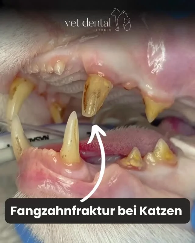 Fangzahnfraktur bei Katzen Nicht jeder Zahn ist ein Fall für die Extraktion!Ein abgebrochener Fangzahn sieht oft dramatisch aus — und ja, er kann schmerzhaft sein. Aber: Ziehen ist nicht immer die einzige Lösung.Dieser kleine Patient kommt seit drei Jahren regelmässig zur Kontrolle und professionellen Zahnreinigung. Sein Fangzahn wurde damals mittels Wurzelbehandlung (Endodontie) versorgt — und schaut euch das Ergebnis an: stabil, funktional und schmerzfrei ✨Warum lohnt es sich, den Zahn zu erhalten?🟢 Der Fangzahn hat eine wichtige Funktion (Greifen, Halten, Orientierung)🟢 Zahnerhalt bedeutet weniger Eingriff als eine Extraktion🟢 Mit der richtigen Nachsorge kann der Zahn langfristig stabil bleibenWichtig ist:👉 Frühe Versorgung nach der Fraktur👉 Regelmässige Kontrollen &amp; Dentalhygiene👉 Gute Nachsorge durch die Besitzer:innenDieser Fall zeigt: Moderne Tierzahnmedizin kann Zähne erhalten — nicht nur entfernen.—Wir sind #vetdentalch – die Spezialisten für Tierzahnmedizin bei Hunden &amp; Katzen in Affoltern am Albis (ZH). 💙—#Katzenzähne #Tierzahnmedizin #Endodontie #Fangzahn #Zahnerhalt #VetLife #Katzengesundheit #Dent