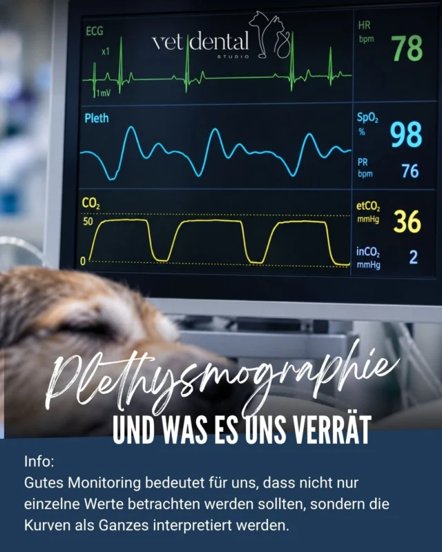❤️ EKG und CO₂ sehen perfekt aus – aber wir können noch mehr erfahren.

Bei diesem Senior-Patienten zeigen Herzfrequenz und Kapnographie einen völlig unauffälligen und stabilen Verlauf.

Doch auch die Plethysmographie liefert wichtige zusätzliche Informationen. 🔎

Sie zeigt die pulsatile Durchblutung im peripheren Gewebe. Form und Amplitude der Pulswelle können Hinweise auf Perfusion und Gefäßtonus geben.

Gerade bei älteren Patienten ist dieser zusätzliche Blick während der Narkose wertvoll:

Nicht nur, wie schnell schlägt das Herz? – sondern auch: Wie kommt jeder Herzschlag in der Peripherie an?

💙 Gutes Monitoring bedeutet für uns deshalb: Nicht nur einzelne Werte betrachten, sondern die Kurven als Ganzes interpretieren.

—
Wir sind #VetdentalCH – die Spezialisten für Tierzahnmedizin bei Hunden & Katzen in Affoltern am Albis (ZH). 🦷🐾
—

#Veterinärmedizin #Anästhesie #VetMed #Tierzahmedizin