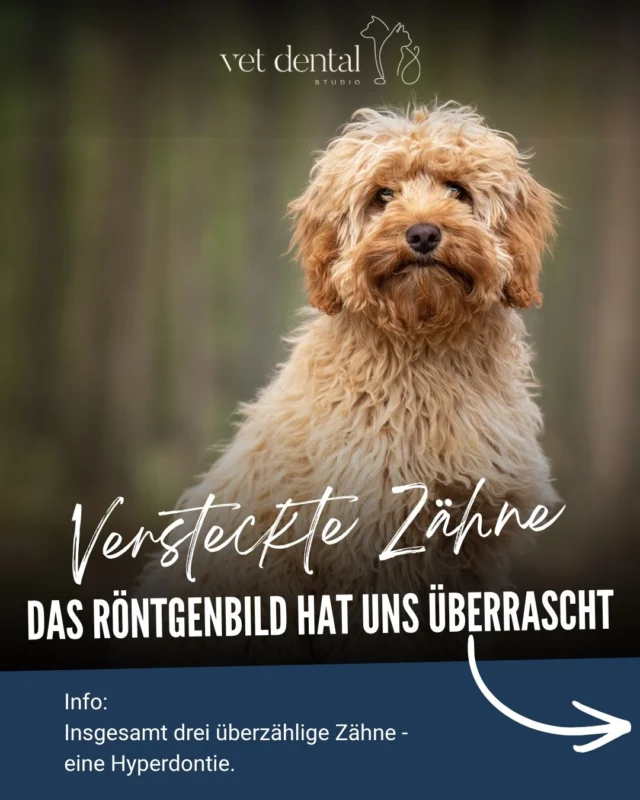 🦷 Die Überraschungszähne – ein besonderer Zufallsbefund

Bei einem Cavapoo mit einer Fistel am rechten Oberkiefer-P4 zeigte sich unter Anästhesie eine kleine Überraschung: Hinter dem P4 versteckte sich ein überzähliger Zahn.

Im wachen Zustand war dieser klinisch nicht zu erkennen. Erst die gründliche Untersuchung unter Anästhesie und das Dentalröntgen brachten den Befund ans Licht. Der zusätzliche Zahn besass sogar zwei eigene Wurzeln.

Doch damit nicht genug: Hinter dem letzten Oberkiefer-Molaren befand sich auf jeder Seite ebenfalls ein überzähliger Zahn.

🦷 Insgesamt drei überzählige Zähne – eine Hyperdontie.

Ein spannender Fall, der zeigt, wie wichtig die Untersuchung unter Anästhesie und das Dentalröntgen in der Tierzahnmedizin sind. Denn manche Befunde bleiben im wachen Zustand einfach verborgen. 🐶

—
Wir sind #VetdentalCH – die Spezialisten für Tierzahnmedizin bei Hunden & Katzen in Affoltern am Albis (ZH). 💙
—

#Tierzahnmedizin #Dentalröntgen #Hyperdontie #Hundezähne
